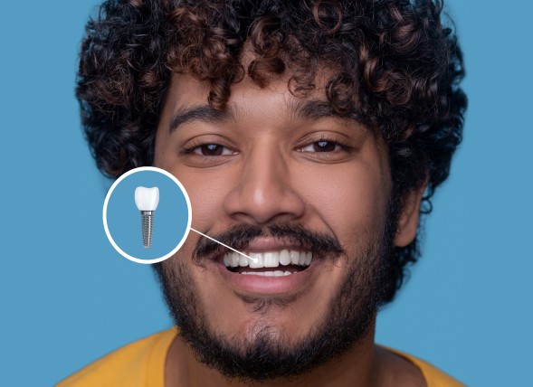 photo young man with a toothy smile demonstrating his dental implant