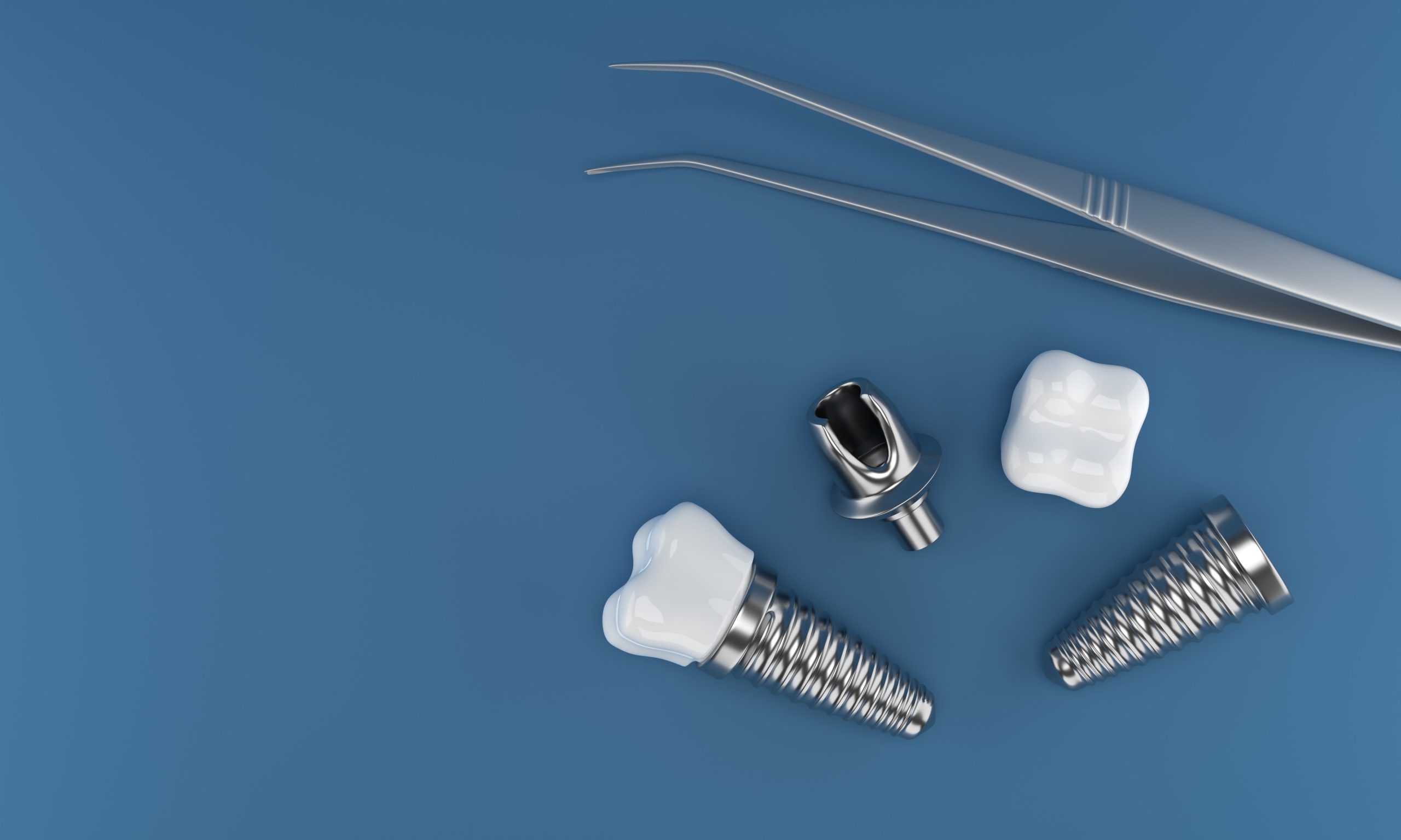 Dental implants surgery 3d rendering