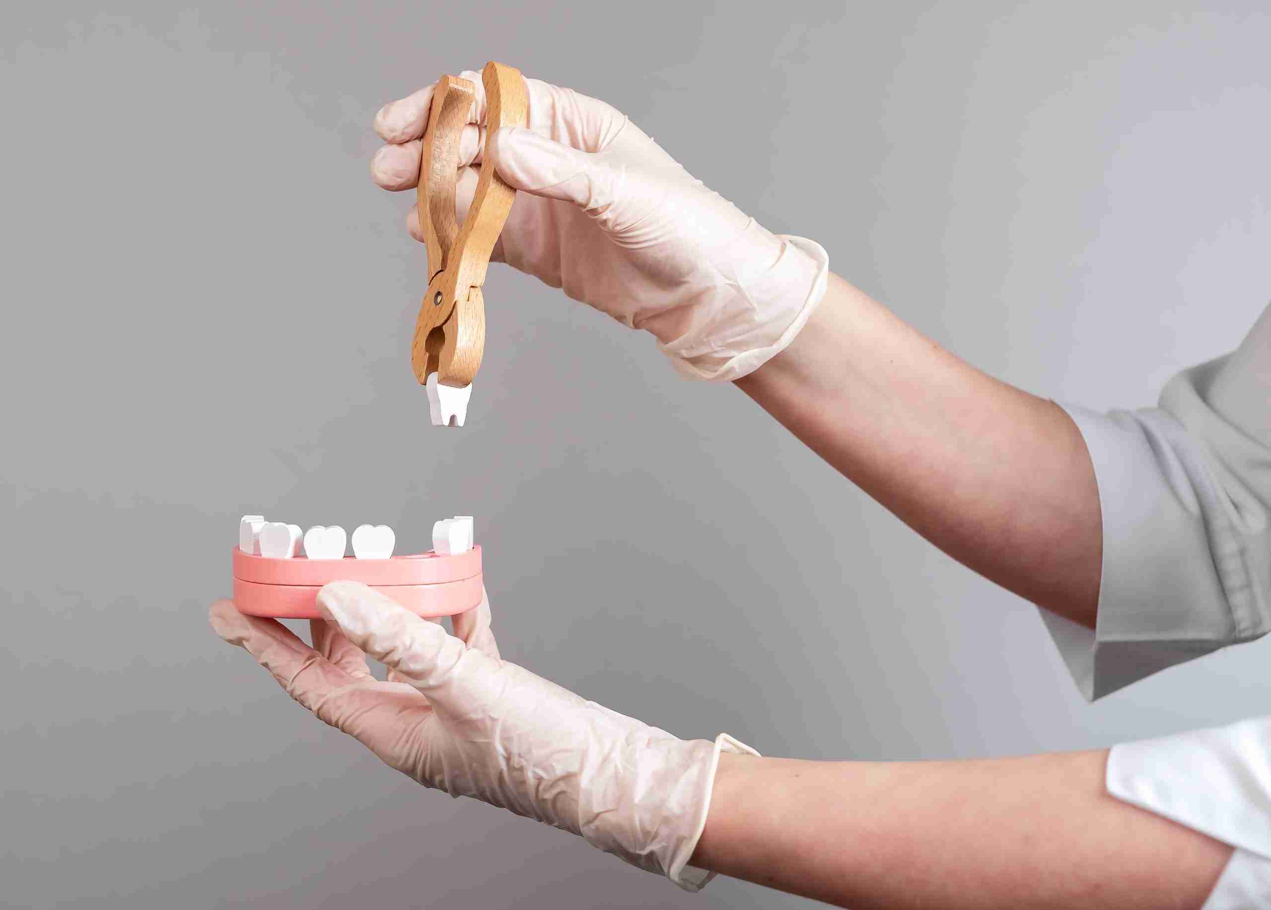 The Ultimate Guide to Wisdom Teeth Extraction in Astoria, Queens: What to Expect