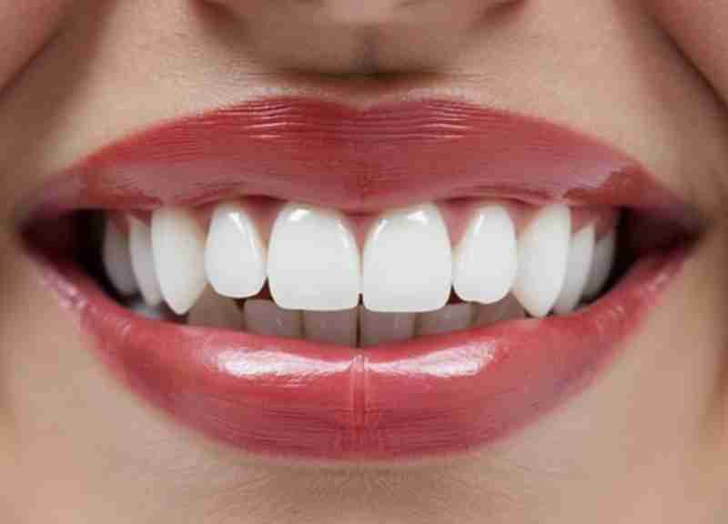 Transform Your Smile with All-on-4 Dentures at Luna Dental in Astoria, NY