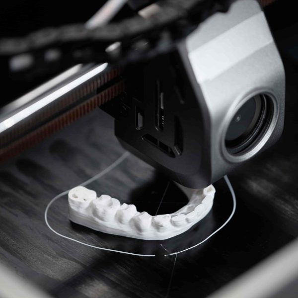 3D printer creating a custom dental model at Luna Dental Astoria