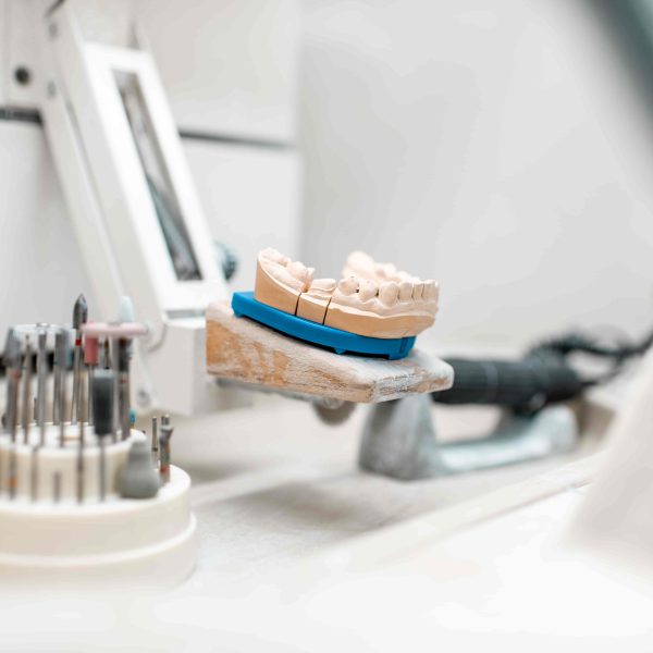 In-house dental lab equipment and custom dental model at Luna Dental Astoria